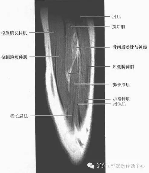 前臂精细解剖+详细标注