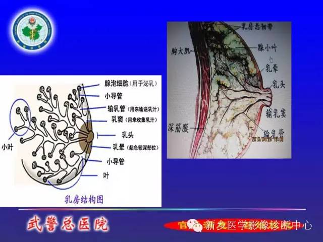 【PPT】MRI对乳腺疾病的诊断