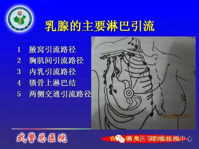 【PPT】MRI对乳腺疾病的诊断