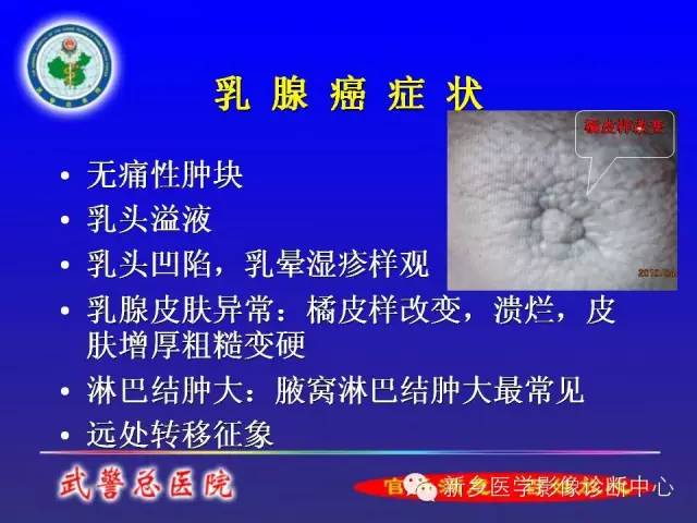 【PPT】MRI对乳腺疾病的诊断