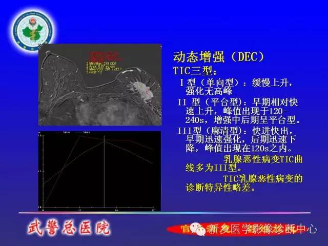 【PPT】MRI对乳腺疾病的诊断
