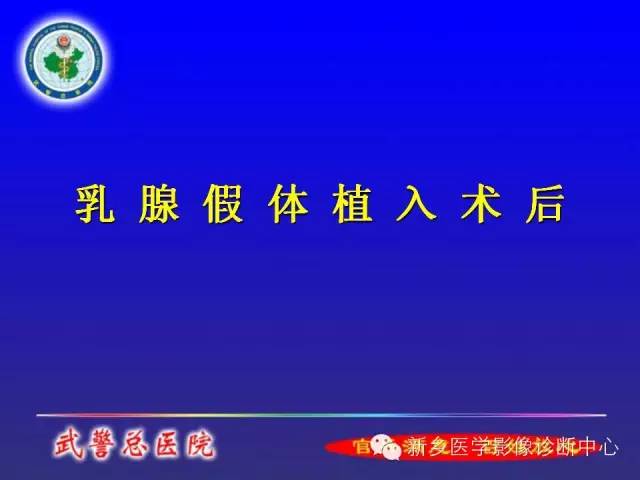 【PPT】MRI对乳腺疾病的诊断