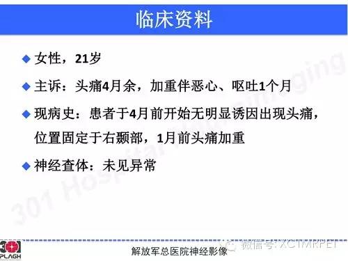 【病例】鞍旁软骨肉瘤1例CT及MR影像表现
