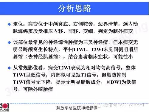 【病例】鞍旁软骨肉瘤1例CT及MR影像表现
