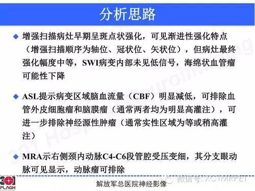 【病例】鞍旁软骨肉瘤1例CT及MR影像表现