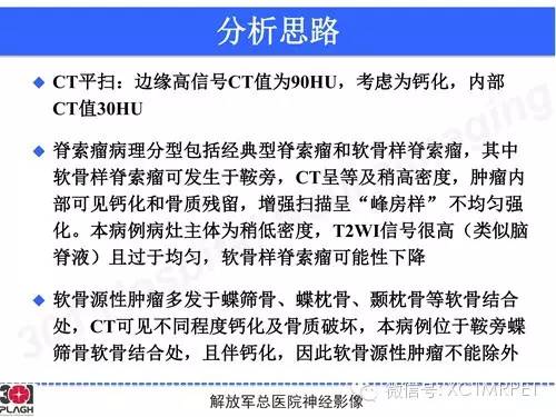 【病例】鞍旁软骨肉瘤1例CT及MR影像表现