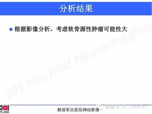【病例】鞍旁软骨肉瘤1例CT及MR影像表现