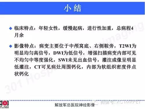 【病例】鞍旁软骨肉瘤1例CT及MR影像表现