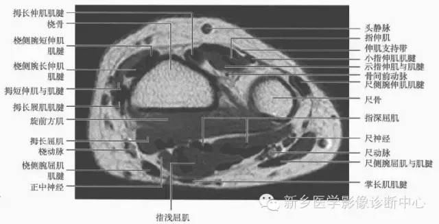 腕关节MR断层解剖+详细标注