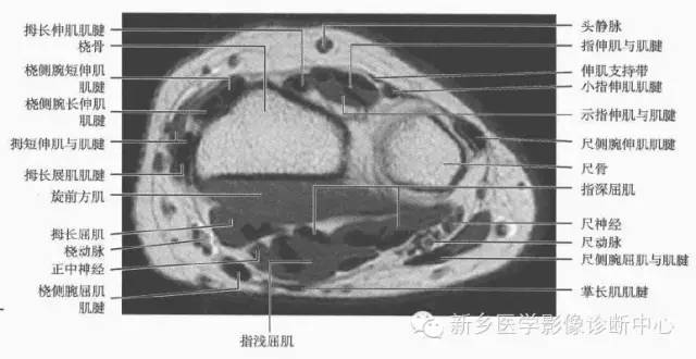 腕关节MR断层解剖+详细标注