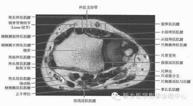 腕关节MR断层解剖+详细标注