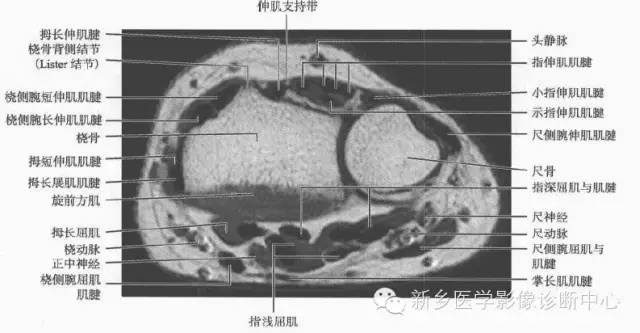 腕关节MR断层解剖+详细标注