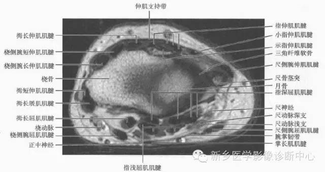 腕关节MR断层解剖+详细标注