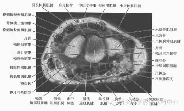 腕关节MR断层解剖+详细标注