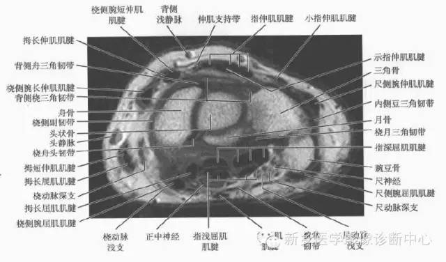 腕关节MR断层解剖+详细标注