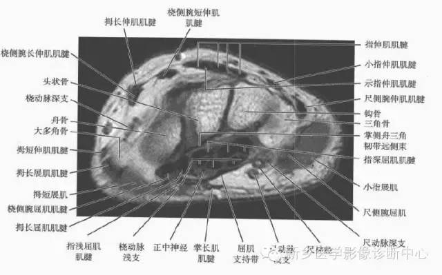 腕关节MR断层解剖+详细标注