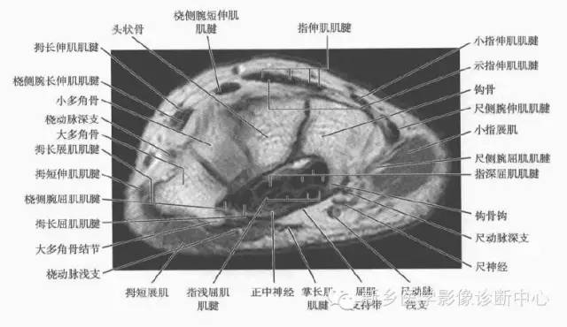 腕关节MR断层解剖+详细标注