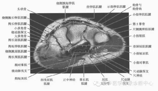 腕关节MR断层解剖+详细标注
