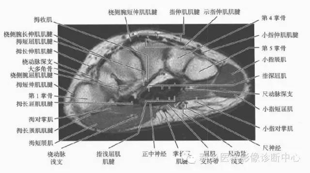 腕关节MR断层解剖+详细标注