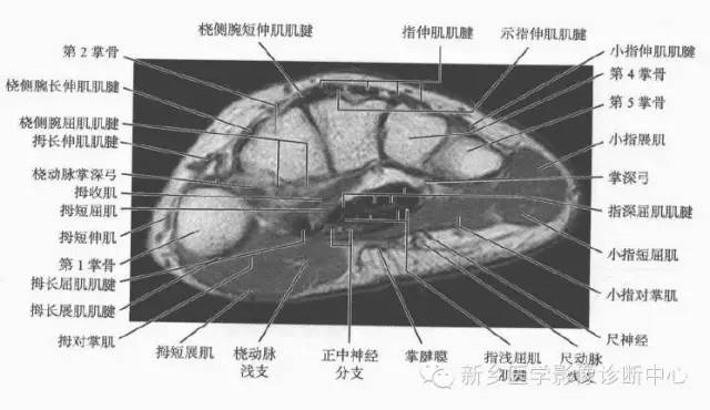 腕关节MR断层解剖+详细标注