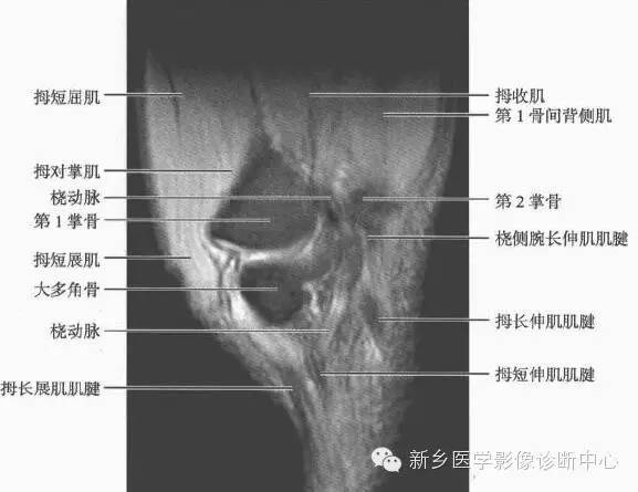 腕关节MR断层解剖+详细标注