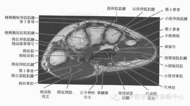腕关节MR断层解剖+详细标注