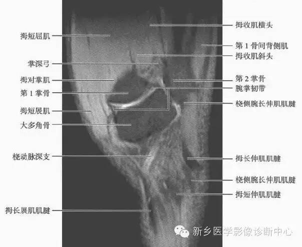 腕关节MR断层解剖+详细标注