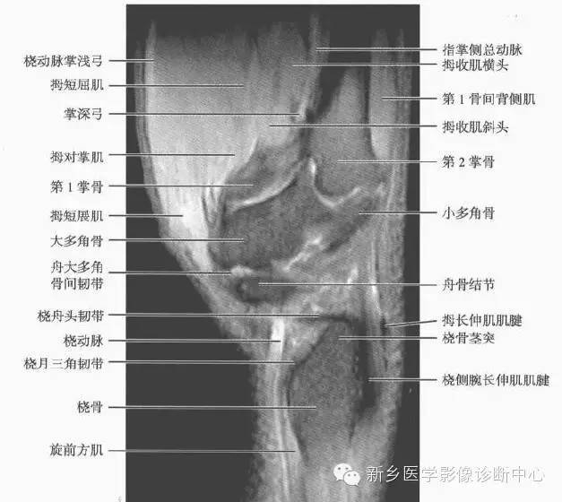 腕关节MR断层解剖+详细标注