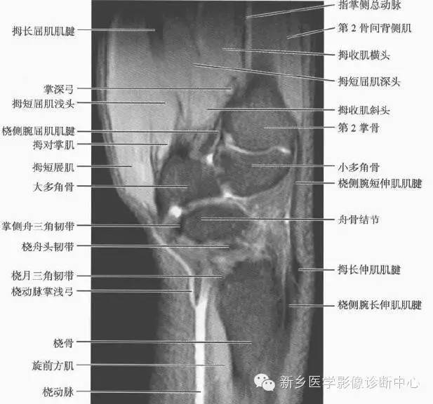 腕关节MR断层解剖+详细标注