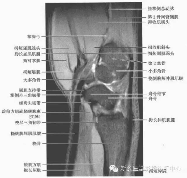 腕关节MR断层解剖+详细标注