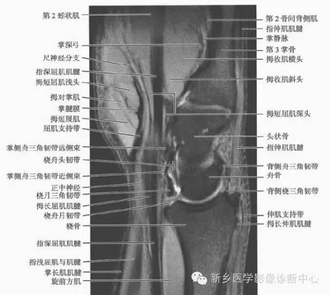 腕关节MR断层解剖+详细标注