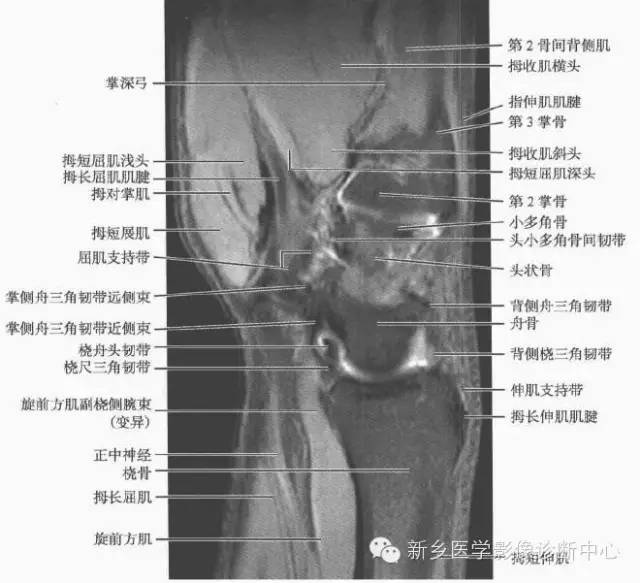 腕关节MR断层解剖+详细标注