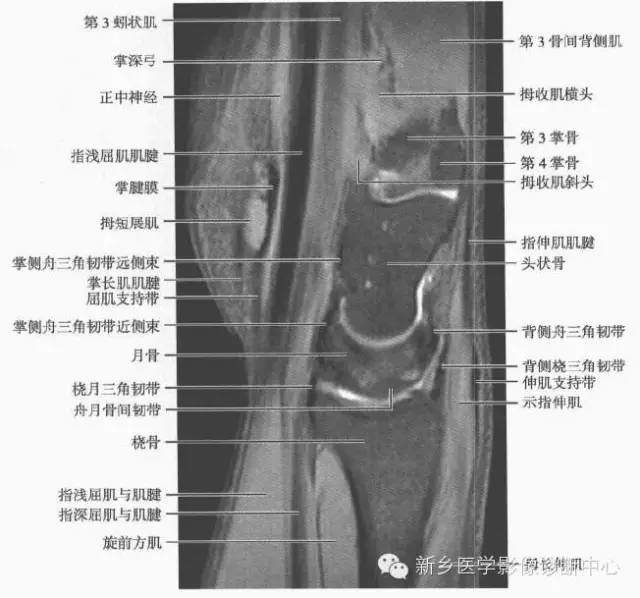腕关节MR断层解剖+详细标注