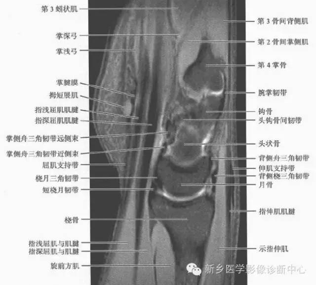 腕关节MR断层解剖+详细标注