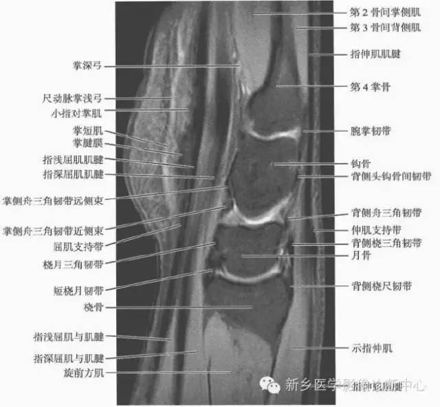 腕关节MR断层解剖+详细标注