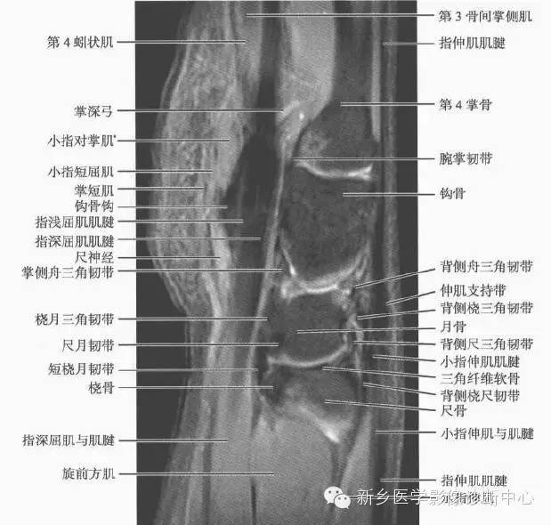 腕关节MR断层解剖+详细标注
