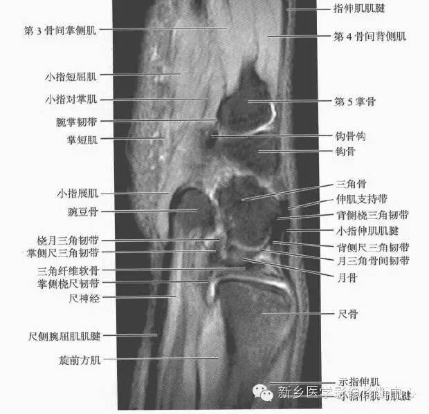 腕关节MR断层解剖+详细标注