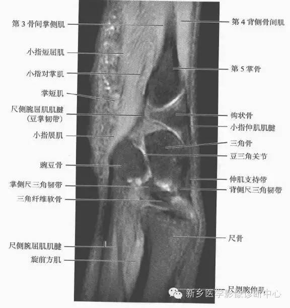腕关节MR断层解剖+详细标注