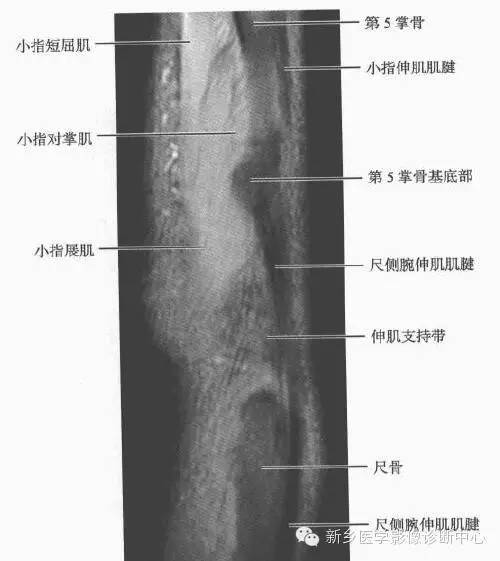 腕关节MR断层解剖+详细标注