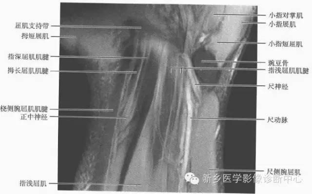 腕关节MR断层解剖+详细标注
