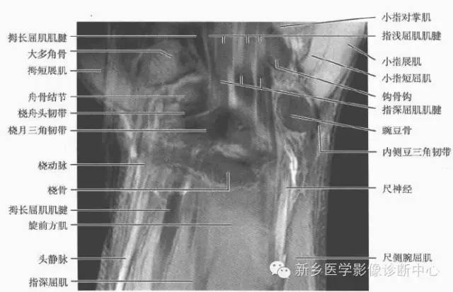 腕关节MR断层解剖+详细标注