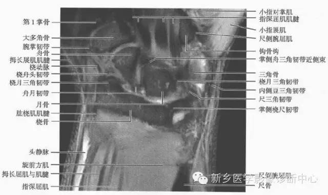 腕关节MR断层解剖+详细标注