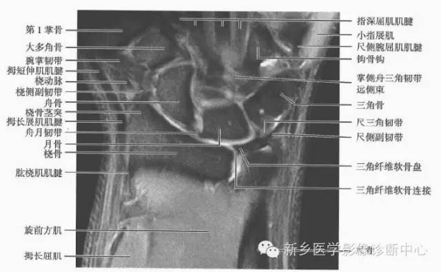 腕关节MR断层解剖+详细标注
