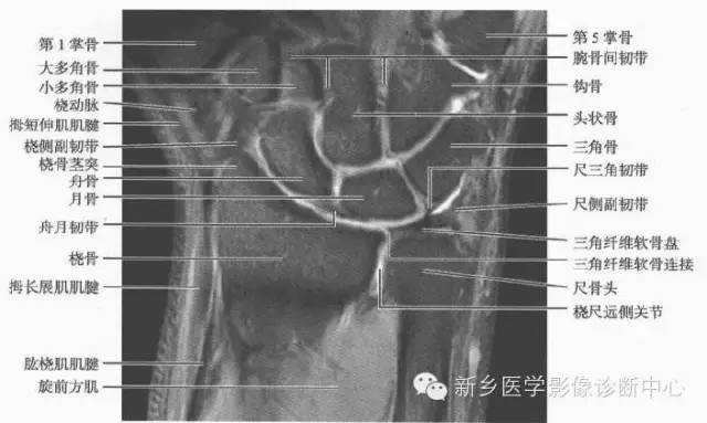 腕关节MR断层解剖+详细标注