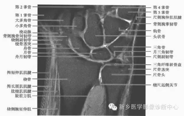 腕关节MR断层解剖+详细标注
