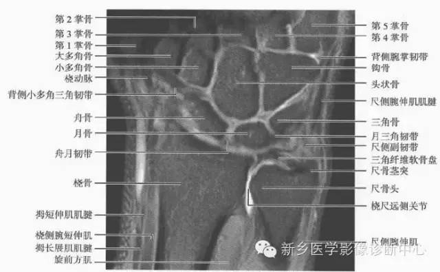 腕关节MR断层解剖+详细标注