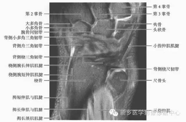 腕关节MR断层解剖+详细标注
