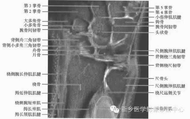 腕关节MR断层解剖+详细标注