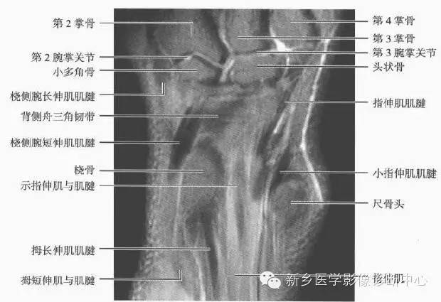 腕关节MR断层解剖+详细标注