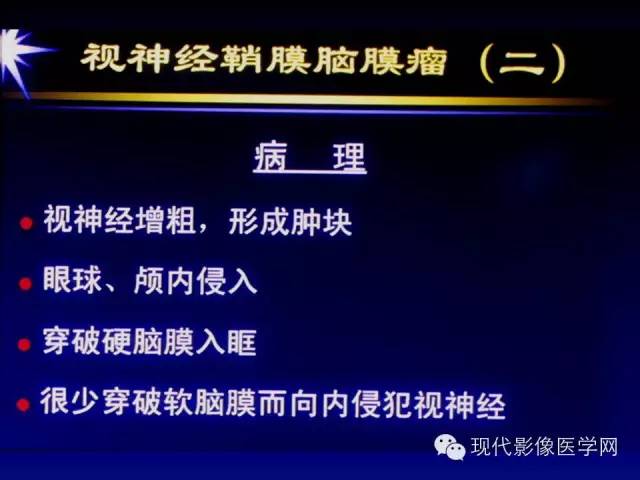 【PPT】眼眶肿瘤的CT MRI诊断